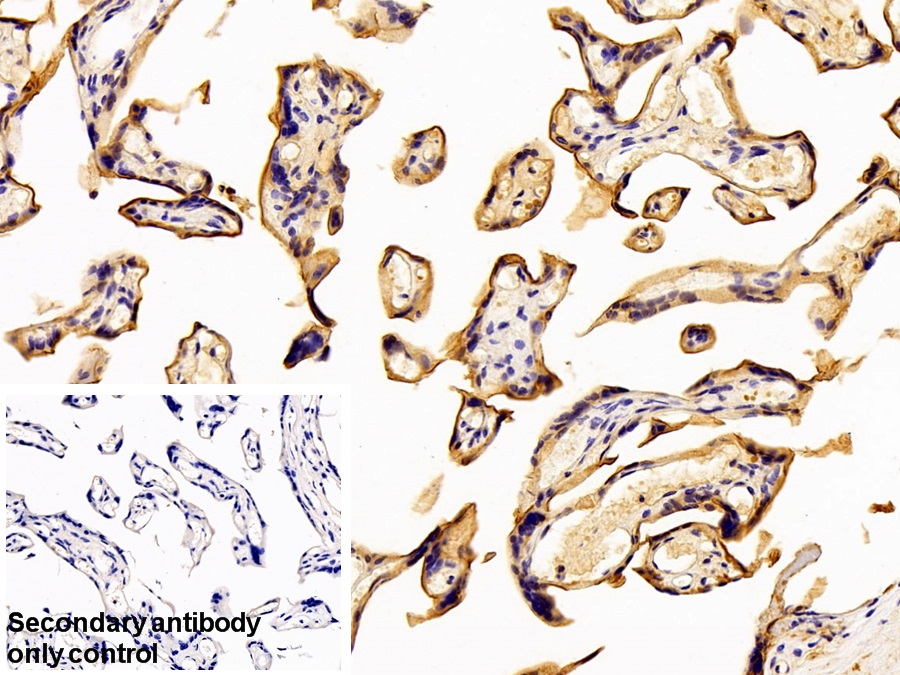 Polyclonal Antibody to Cluster Of Differentiation 73 (CD73)