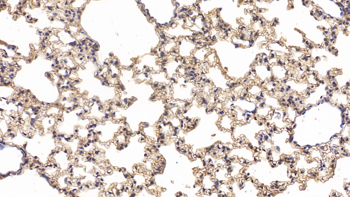 Polyclonal Antibody to Cluster Of Differentiation 73 (CD73)