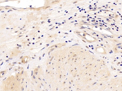 Polyclonal Antibody to Androgen Receptor (AR)