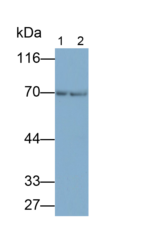 Polyclonal Antibody to Androgen Receptor (AR)