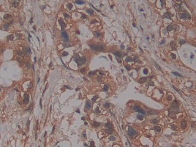 Polyclonal Antibody to Prolylcarboxypeptidase (PRCP)