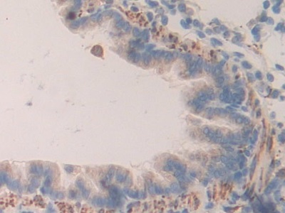 Polyclonal Antibody to Prolylcarboxypeptidase (PRCP)