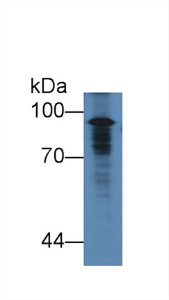 Polyclonal Antibody to Angiostatin (ANG)