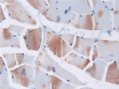 Polyclonal Antibody to Elongin A (ELOA)