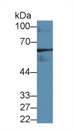 Polyclonal Antibody to Glutamate Decarboxylase 2 (GAD2)