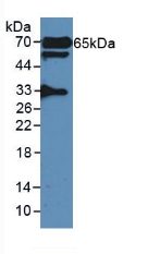 Polyclonal Antibody to Glutamate Decarboxylase 2 (GAD2)