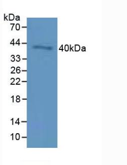 Polyclonal Antibody to Cluster Of Differentiation 72 (CD72)