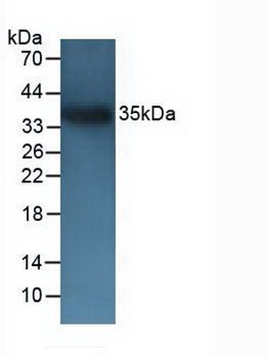 Polyclonal Antibody to Cluster Of Differentiation 72 (CD72)