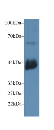 Polyclonal Antibody to Cluster Of Differentiation 72 (CD72)