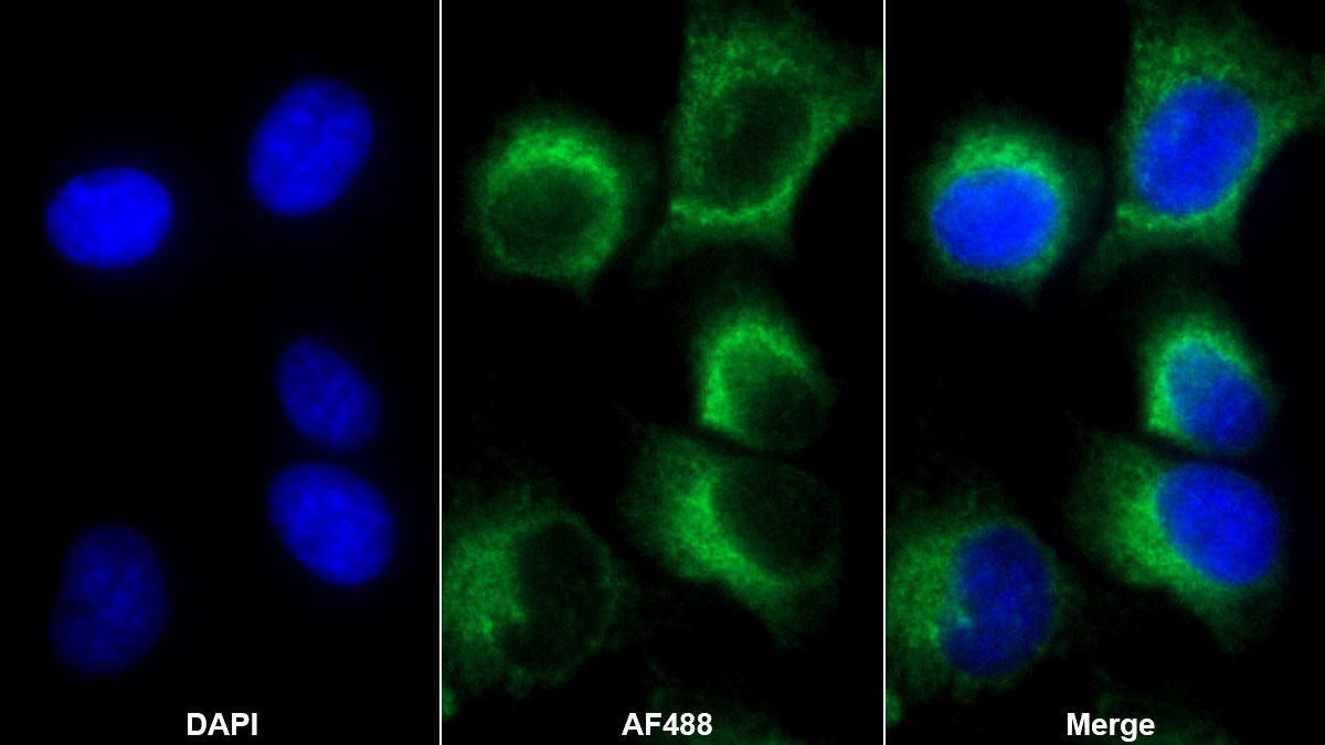 Polyclonal Antibody to Integrin Beta 3 (ITGb3)