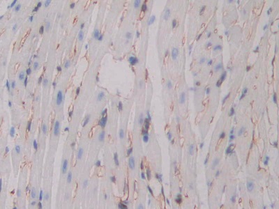 Polyclonal Antibody to Integrin Beta 3 (ITGb3)