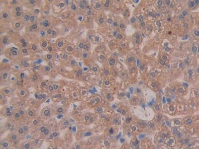 Polyclonal Antibody to Integrin Beta 3 (ITGb3)