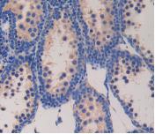 Polyclonal Antibody to Glucagon (GCG)