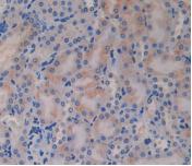 Polyclonal Antibody to Glucagon (GCG)