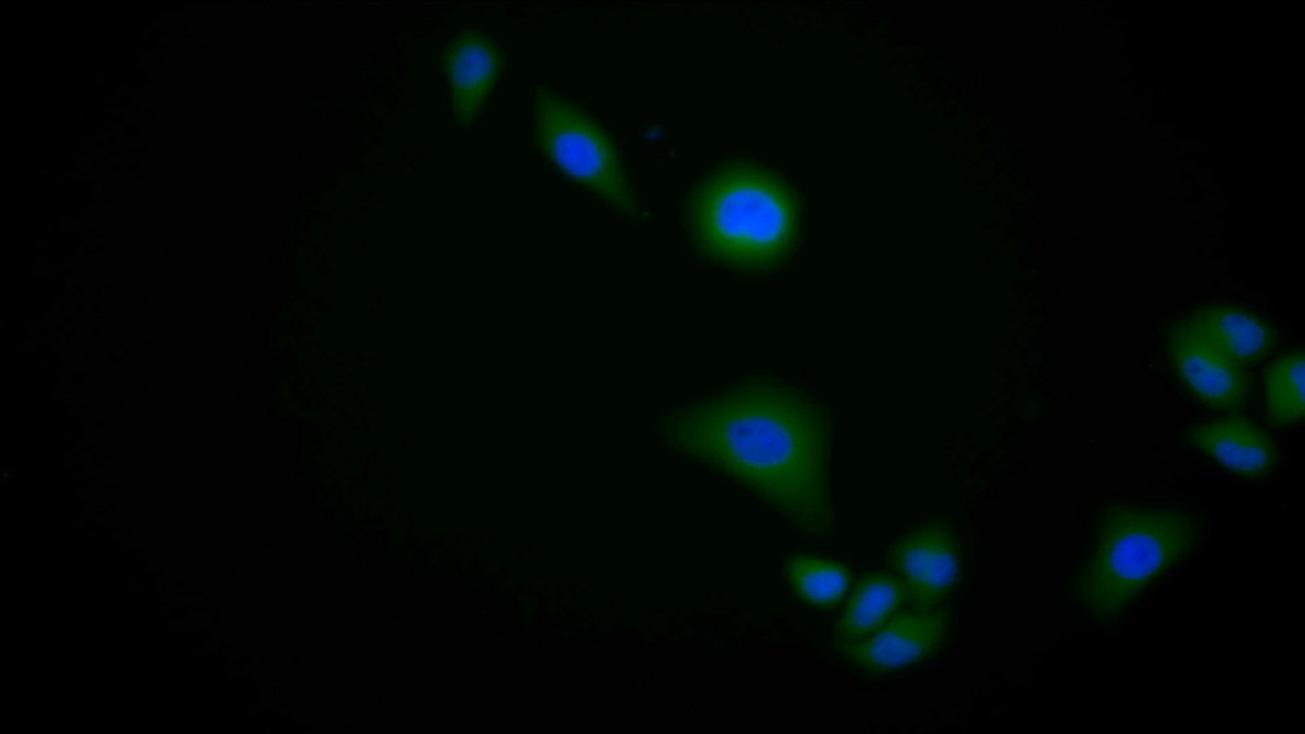 Polyclonal Antibody to Kininogen 1 (KNG1)