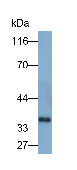 Polyclonal Antibody to Sulfotransferase 1A1 (SULT1A1)