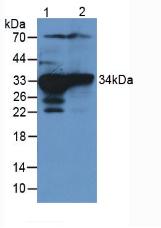 Polyclonal Antibody to Sulfotransferase 1A1 (SULT1A1)