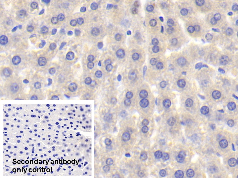 Polyclonal Antibody to Sulfotransferase 1A1 (SULT1A1)