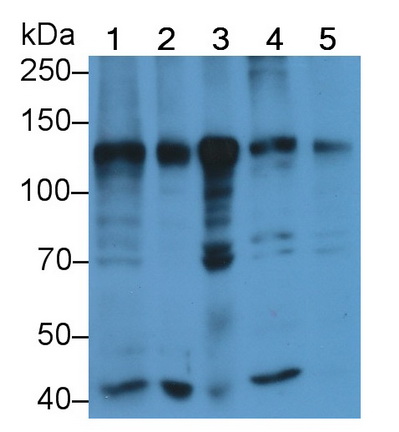 Polyclonal Antibody to ATP Dependent DNA ligase I (LIG1)