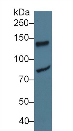 Polyclonal Antibody to ATP Dependent DNA ligase I (LIG1)