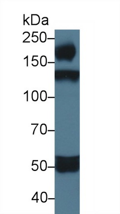 Polyclonal Antibody to ATP Dependent DNA ligase I (LIG1)