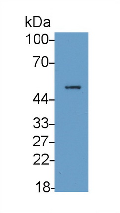 Polyclonal Antibody to Fc Fragment Of IgG Low Affinity IIIa Receptor (FcgR3A)