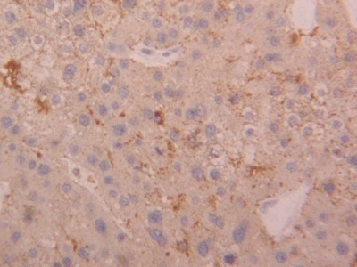 Polyclonal Antibody to Cathepsin D (CTSD)