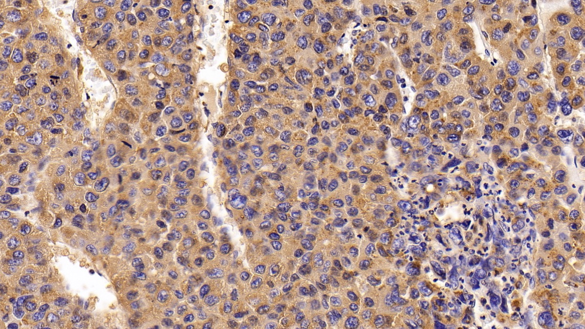 Polyclonal Antibody to Cathepsin D (CTSD)