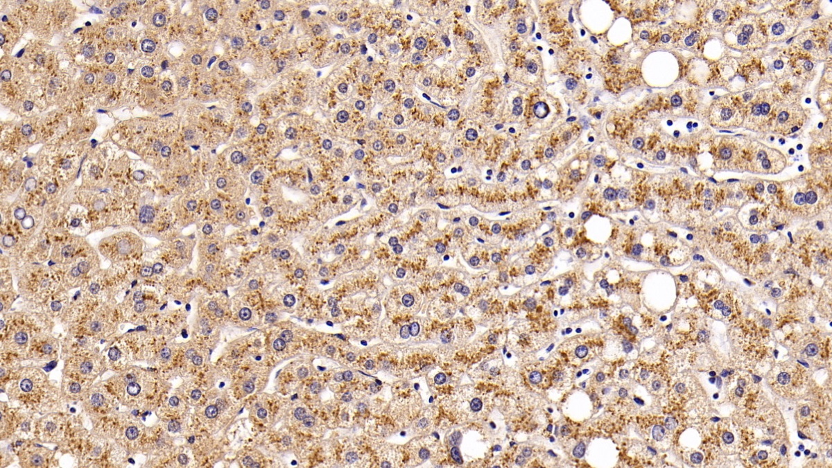 Polyclonal Antibody to Cathepsin D (CTSD)