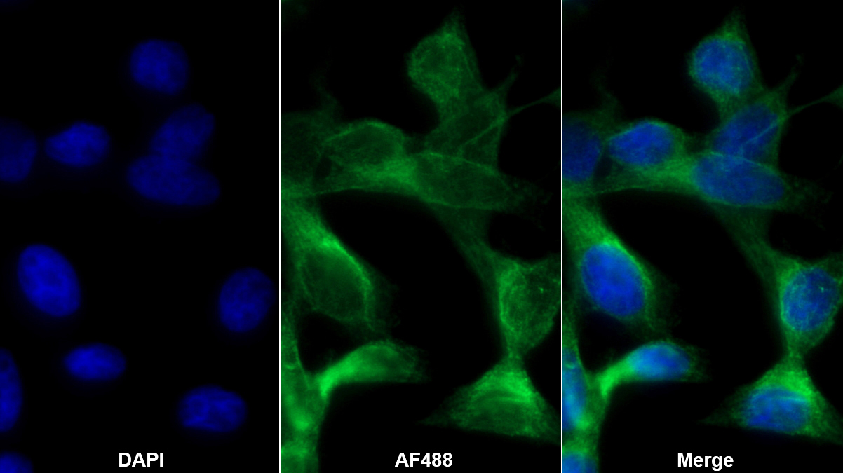 Polyclonal Antibody to Cathepsin D (CTSD)