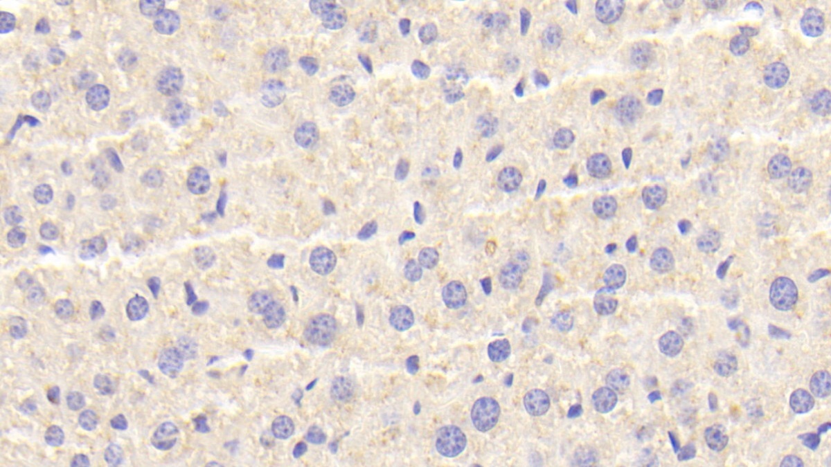 Polyclonal Antibody to Cathepsin D (CTSD)