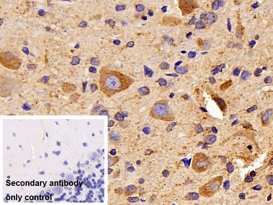 Polyclonal Antibody to Cathepsin D (CTSD)