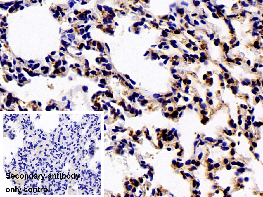 Polyclonal Antibody to Cathepsin D (CTSD)