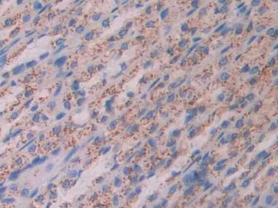 Polyclonal Antibody to Cathepsin D (CTSD)