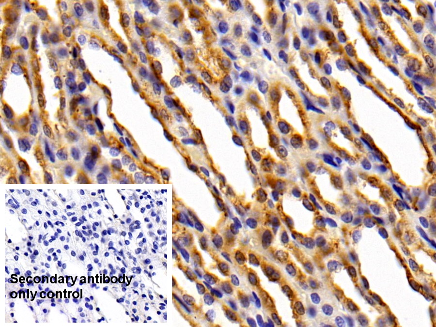 Polyclonal Antibody to Cathepsin D (CTSD)