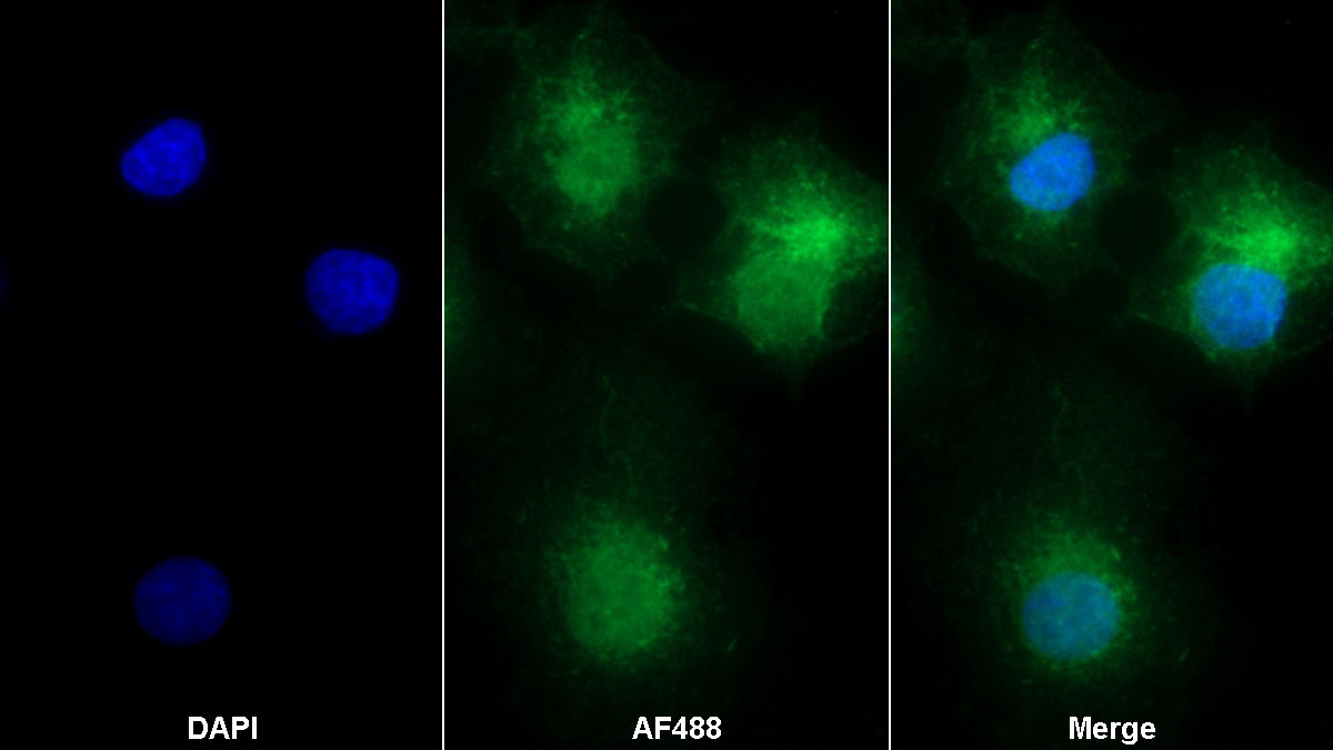 Polyclonal Antibody to Integrin Alpha V (ITGaV)