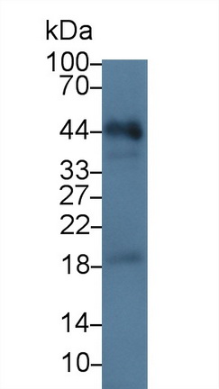 Polyclonal Antibody to Epithelial Cell Adhesion Molecule (EPCAM)