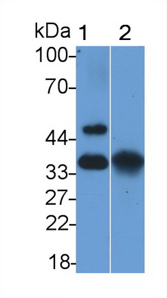 Polyclonal Antibody to Epithelial Cell Adhesion Molecule (EPCAM)