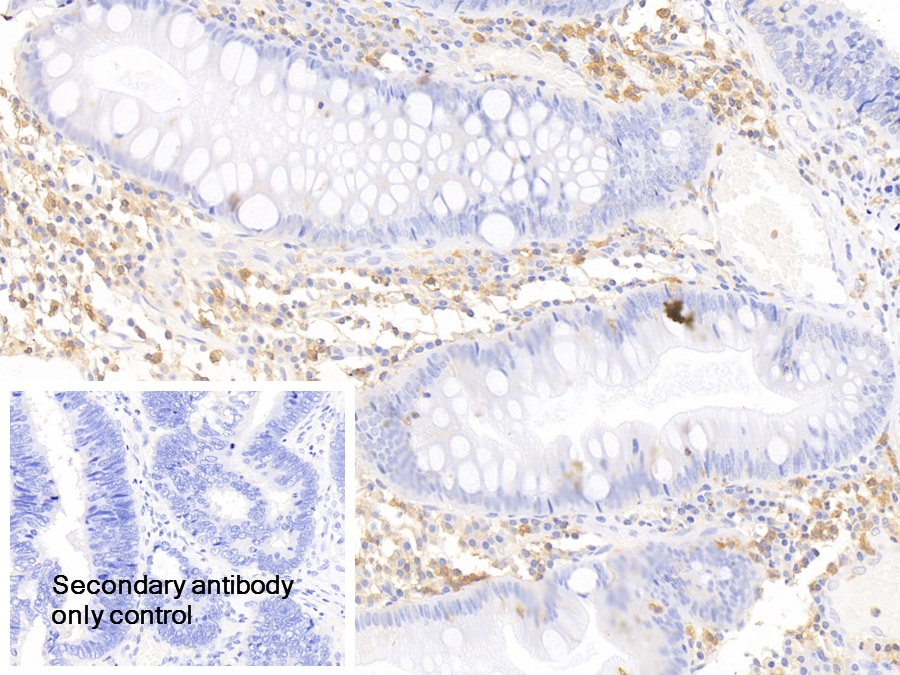 Polyclonal Antibody to Epithelial Cell Adhesion Molecule (EPCAM)