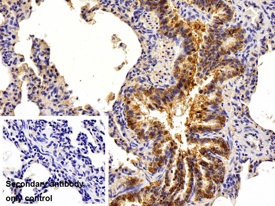 Polyclonal Antibody to Epithelial Cell Adhesion Molecule (EPCAM)