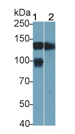 Polyclonal Antibody to Integrin Alpha 5 (ITGa5)