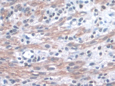 Polyclonal Antibody to Integrin Alpha 3 (ITGa3)