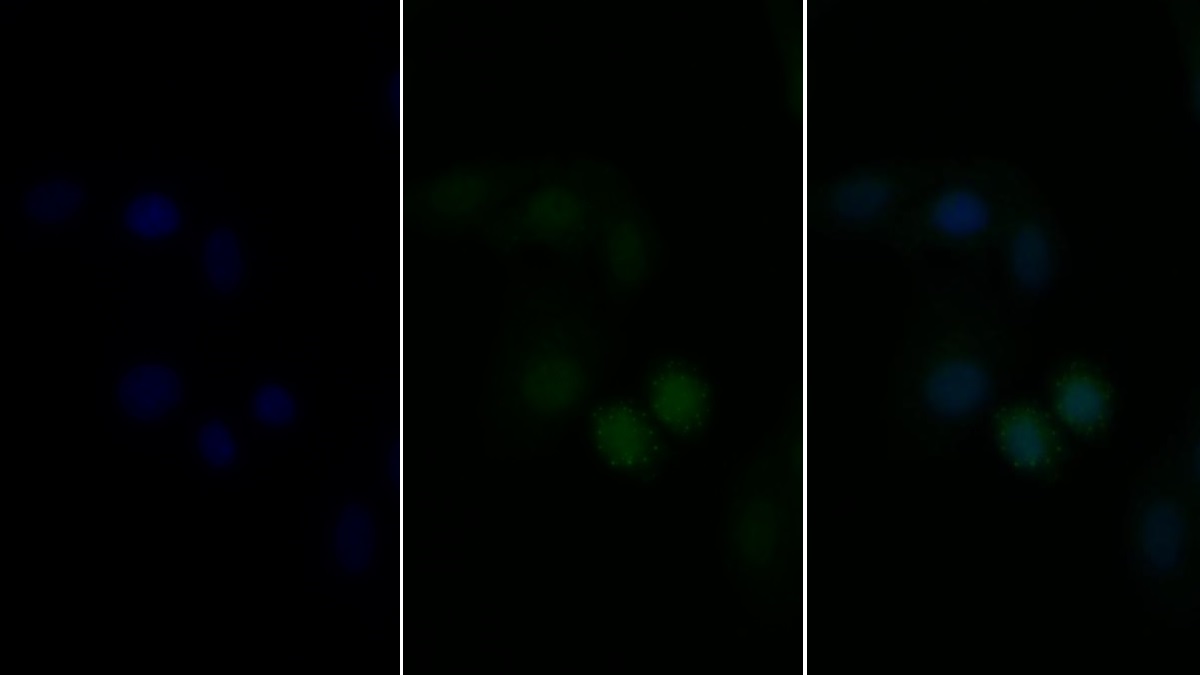 Polyclonal Antibody to V-Fos FBJ Murine Osteosarcoma Viral Oncogene Homolog (FOS)