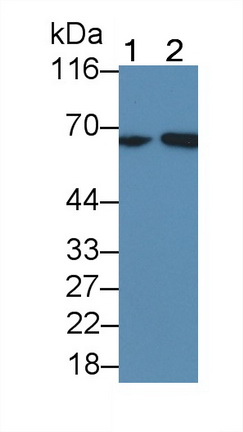 Polyclonal Antibody to V-Fos FBJ Murine Osteosarcoma Viral Oncogene Homolog (FOS)