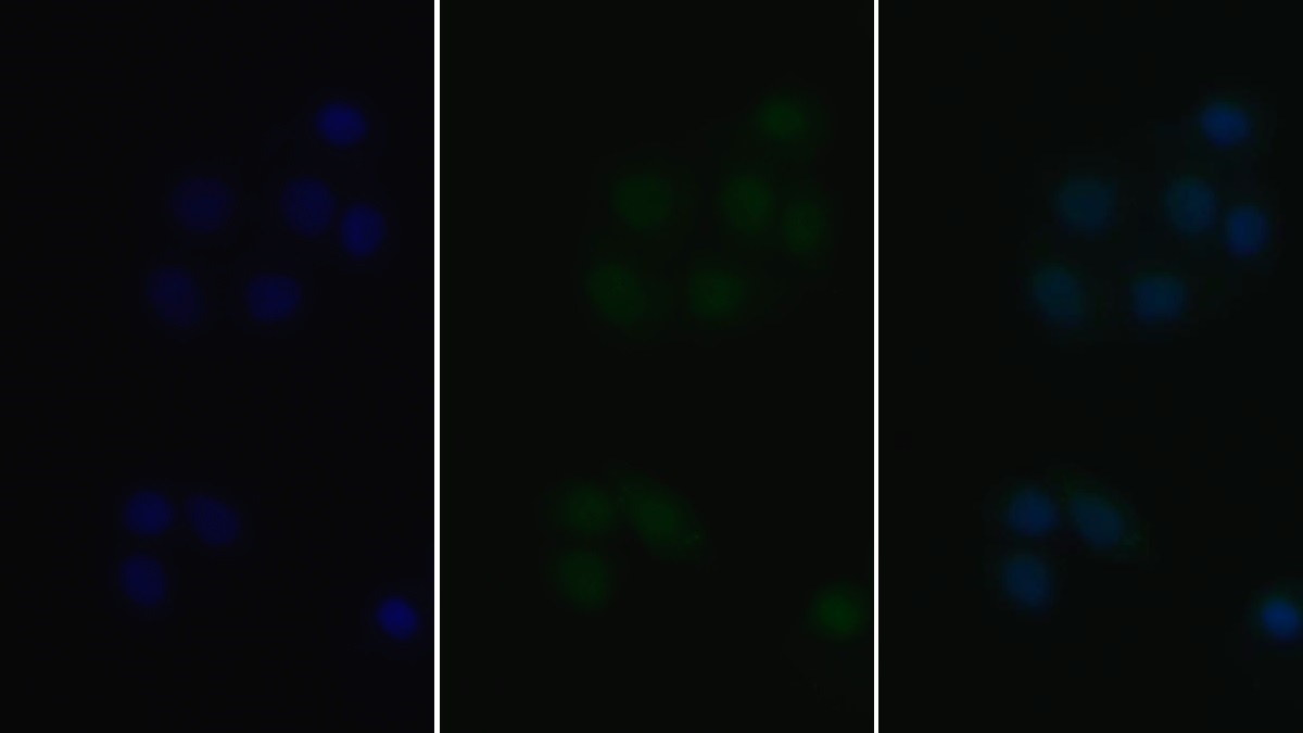 Polyclonal Antibody to V-Fos FBJ Murine Osteosarcoma Viral Oncogene Homolog (FOS)