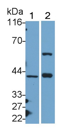 Polyclonal Antibody to V-Jun Sarcoma Virus 17 Oncogene Homolog (JUN)