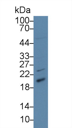 Polyclonal Antibody to V-Ha-Ras Harvey Rat Sarcoma Viral Oncogene Homolog (HRAS)