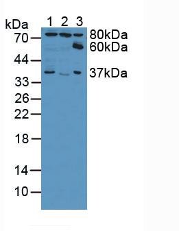 Polyclonal Antibody to Ezrin (EZR)