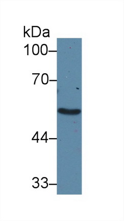 Polyclonal Antibody to Adrenergic Receptor Alpha 1A (ADRa1A)