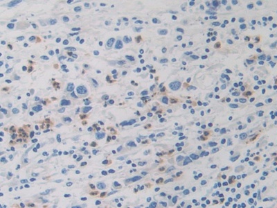 Polyclonal Antibody to Dopamine Receptor D1 (DRD1)